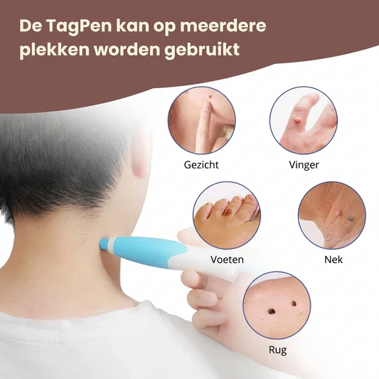 DermaClear™ - Skin Tag Verwijder Pen Kit