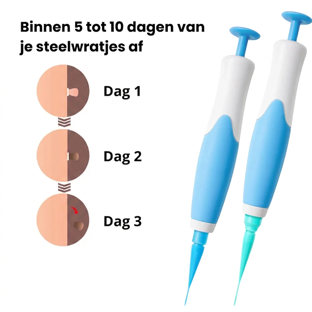 DermaClear™ - Skin Tag Verwijder Pen Kit