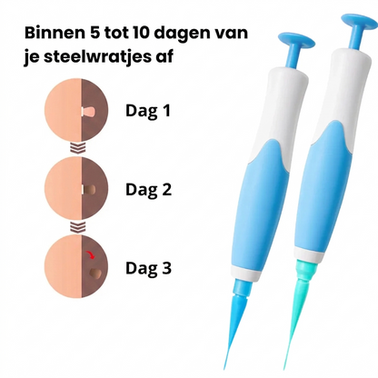 DermaClear™ - Skin Tag Verwijder Pen Kit